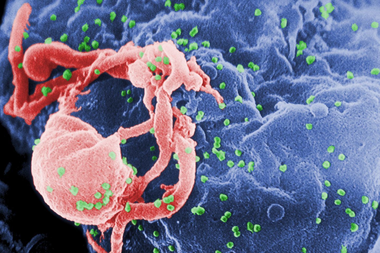 برمجة أجسام مضادة لمهاجمة سلالات فيروس العوز المناعي البشري