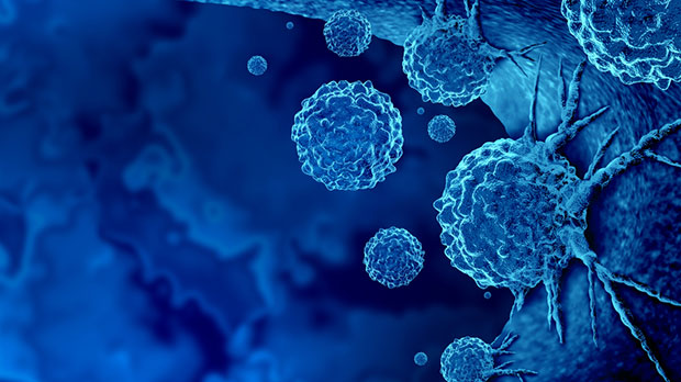 اكتشاف طريقة جديدة غير متوقعة تنتشر بها خلايا السرطان