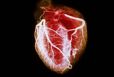 امراض القلب - الجزء الثاني -