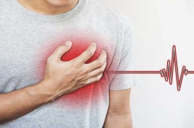 تسرع القلب فوق البطيني الانتيابي (PSVT): الأسباب والأعراض والتشخيص والعلاج - تسرع النبض القلبي فوق المعدل الطبيعي - دقات القلب