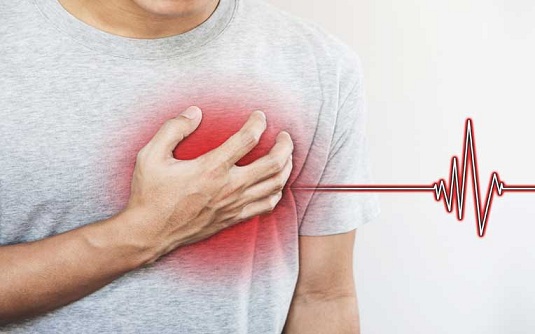 تسرع القلب فوق البطيني الانتيابي (PSVT): الأسباب والأعراض والتشخيص والعلاج
