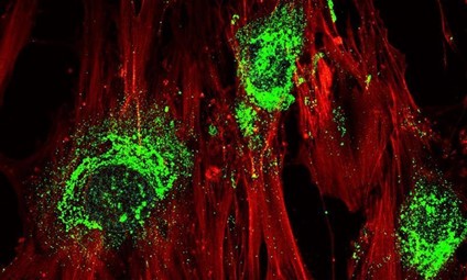 صورة توضح تحول بعض الخلايا الجذعية إلى خلايا عظمية تنتج الكولاجين 