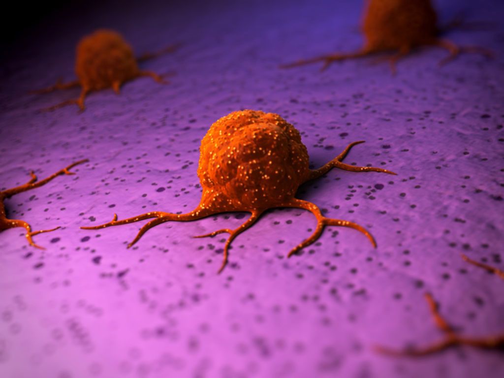 سرطان الخلايا الكبدية: الأسباب والأعراض والتشخيص والعلاج