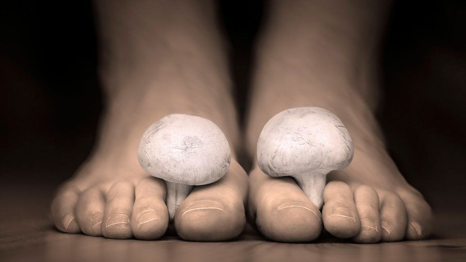 سعفة القدم : الأسباب والأعراض والتشخيص والعلاج