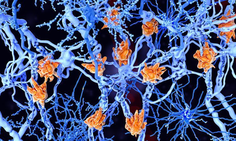 العصبونات البندولية - اكتشاف خلايا عصبية جديدة، تعرف عليها