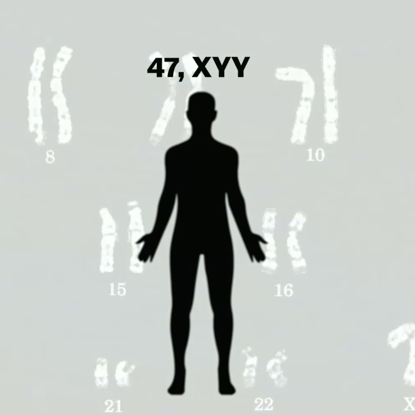 متلازمة XYY: الأسباب والأعراض والتشخيص والعلاج