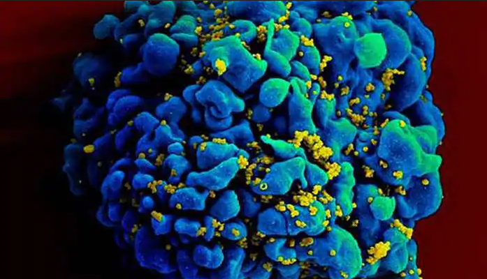 ما هو فيروس شاباري الذي انتشر في بوليفيا وهل يحمل تهديدًا جديدًا للبشرية - حمى نزفية مشابهة لتلك التي يسببها فيروس إيبولا