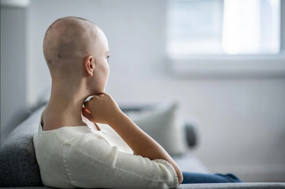 كيف تتعامل مع تساقط الشعر بسبب العلاج الكيميائي؟ - حقائق عن خسارة الشعر بسبب العلاج الكيماوي للسرطان، واستراتيجيات التعامل معها