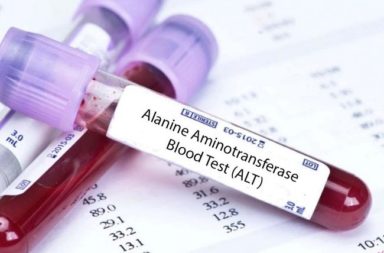 اختبار ألانين أمينو ترانسفيراز ALT - اختبار يقيس مستوى إنزيم ALT في الدم - لماذا يُجرى اختبار ALT؟ ما المخاطر المرتبطة باختبار ALT؟