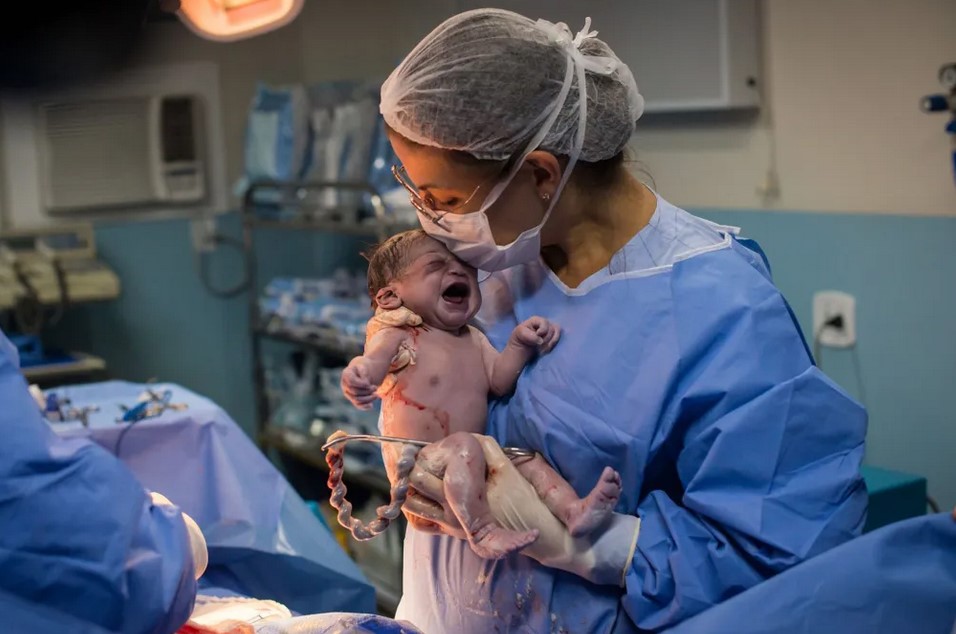 ولادة طفل في البرازيل بذيل بشري بطول 12 سم!