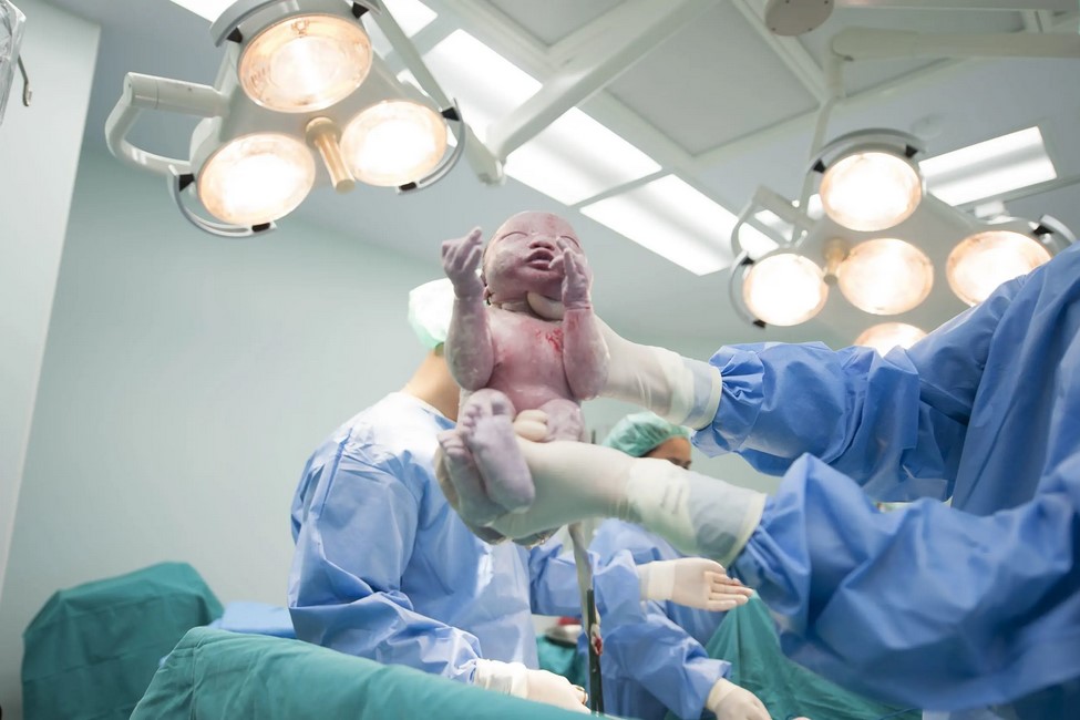 سقوط المشيمة بعد الولادة، إليك ما يجب معرفته