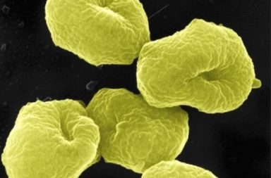 أحد أقدم أشكال الحياة على الأرض التي كانت تصنف سابقًا من البكتيريا - هل العتائق تمثل نطاقًا مستقلًا من الكائنات الحية؟ ما هي الجراثيم البدائية؟