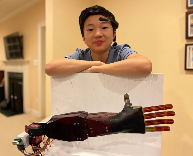 طالب جامعي يخترع ذراعًا اصطناعية يمكنه التحكم فيها بعقله!