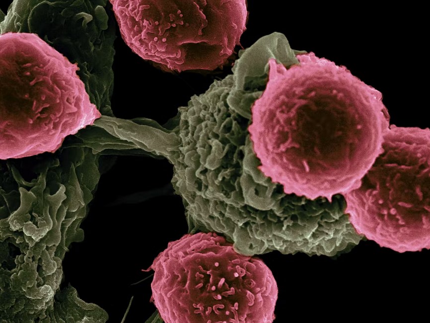 تنتج الخلايا التغصنية (باللون الأخضر) سيتوكينات مثل إنترلوكين 12 قادرة على تدريب الخلايا التائية (باللون الوردي) على مهاجمة الأورام