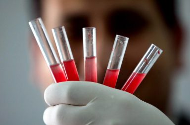 ما زمرة الدم الذهبية؟ كيفية تصنيف الزمر الدموية؟ كشف باحثون عن وجود علاقة بين الزمرة الدموية النظام الغذائي، ما هي هذه العلاقة؟
