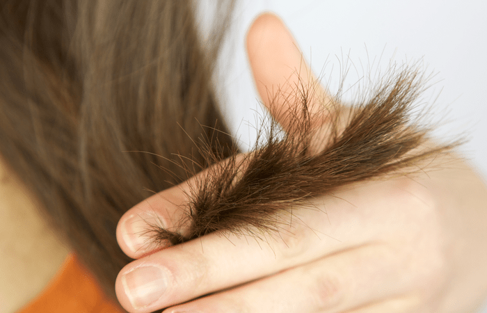 كيفية التخلص من تقصف الشعر