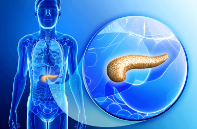 التهاب البنكرياس المزمن chronic pancreatitis الأسباب والأعراض والتشخيص والعلاج الهرمونات التي تساعد في هضم الأغذية عضو غدي موجود في البطن