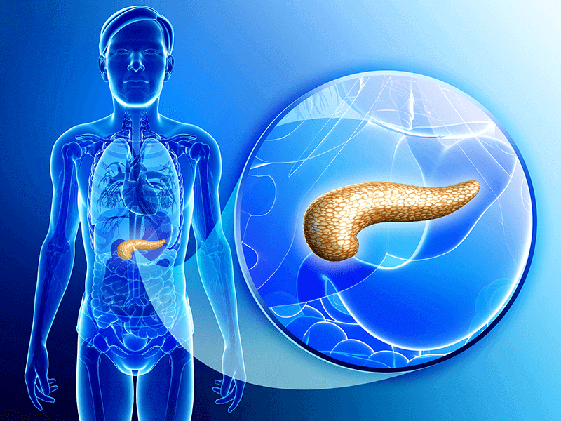 التهاب البنكرياس المزمن chronic pancreatitis