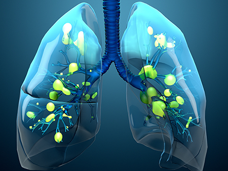 الفشل التنفسي: الأسباب والأعراض والتشخيص والعلاج