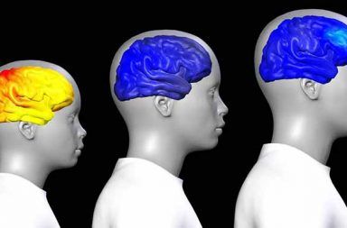 كيف يتغير الدماغ عند البلوغ ؟
