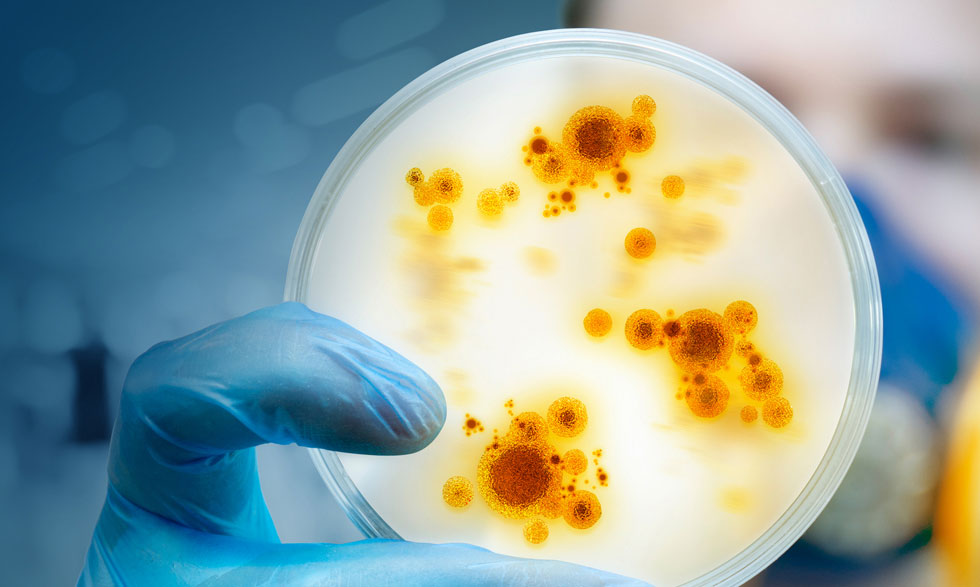 الباحثون يطورون برنامجًا لتحري الجراثيم المقاومة للأدوية - برنامج سهل الاستخدام لتحديد الجراثيم المقاومة للمضادات الحيوية
