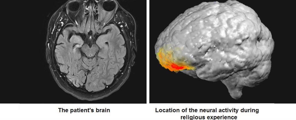 لاول مرة :  تسجيل النشاط الدماغي لرجل في اللحظة التي ادعى فيها " رؤية الله "