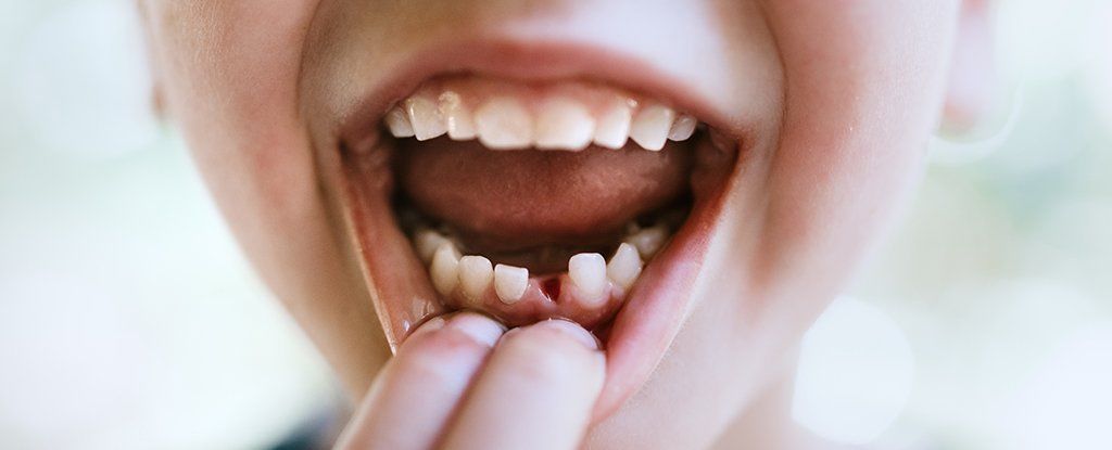أصبح بالإمكان استخدام الخلايا الجذعية من أسنان الأطفال لاستعادة الأسنان الميتة