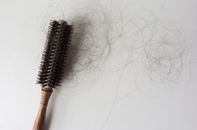 كيف يساعد جريب الشعر في التئام الجروح؟ كيف ينمو الشعر من الجريب؟ هل يُشفى جريب الشعرة من الأذية وهل يعود الشعر للنمو؟ كيف نستطيع تقوية جريب الشعر؟