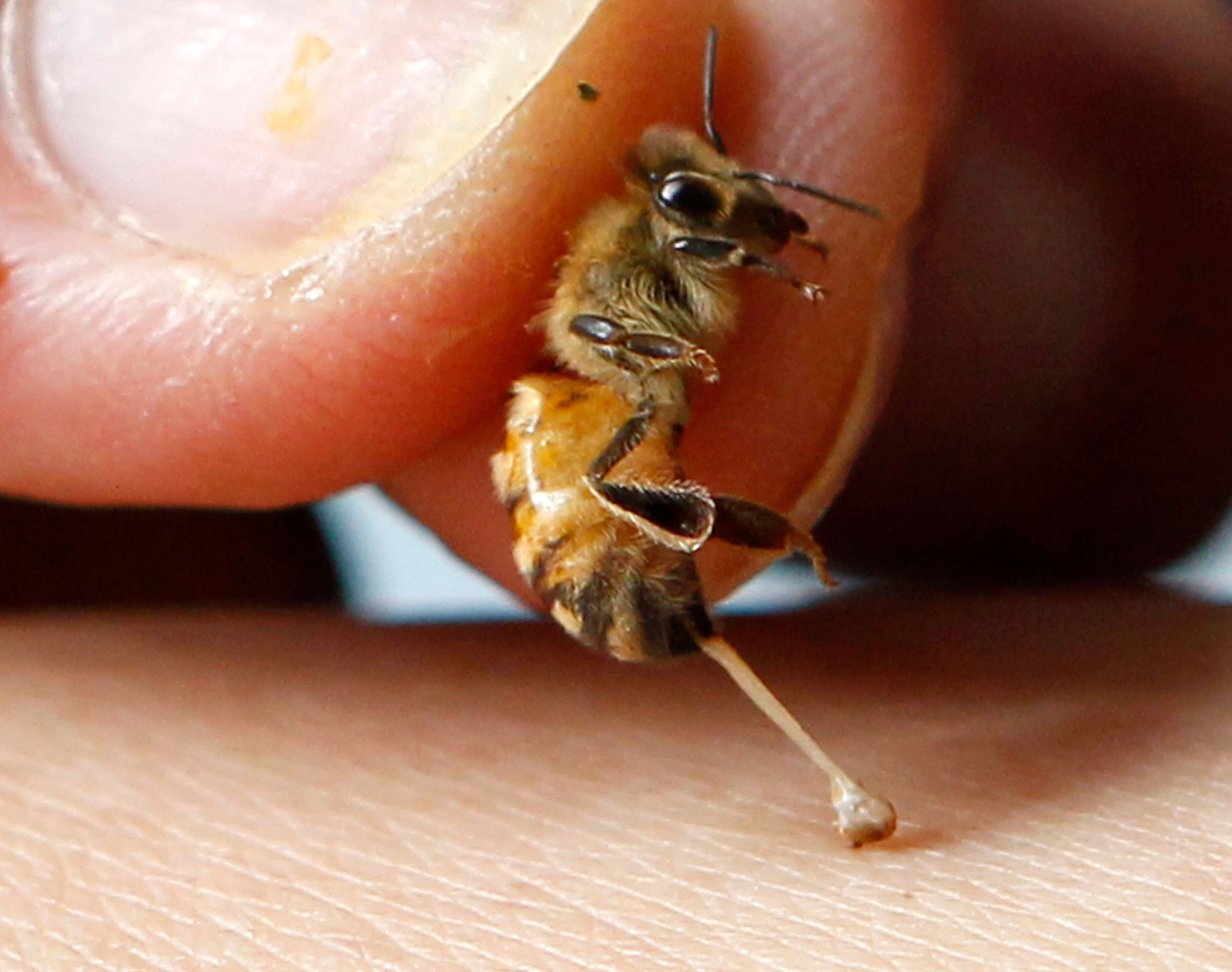 ما هو علاج لسعة النحل في المنزل؟