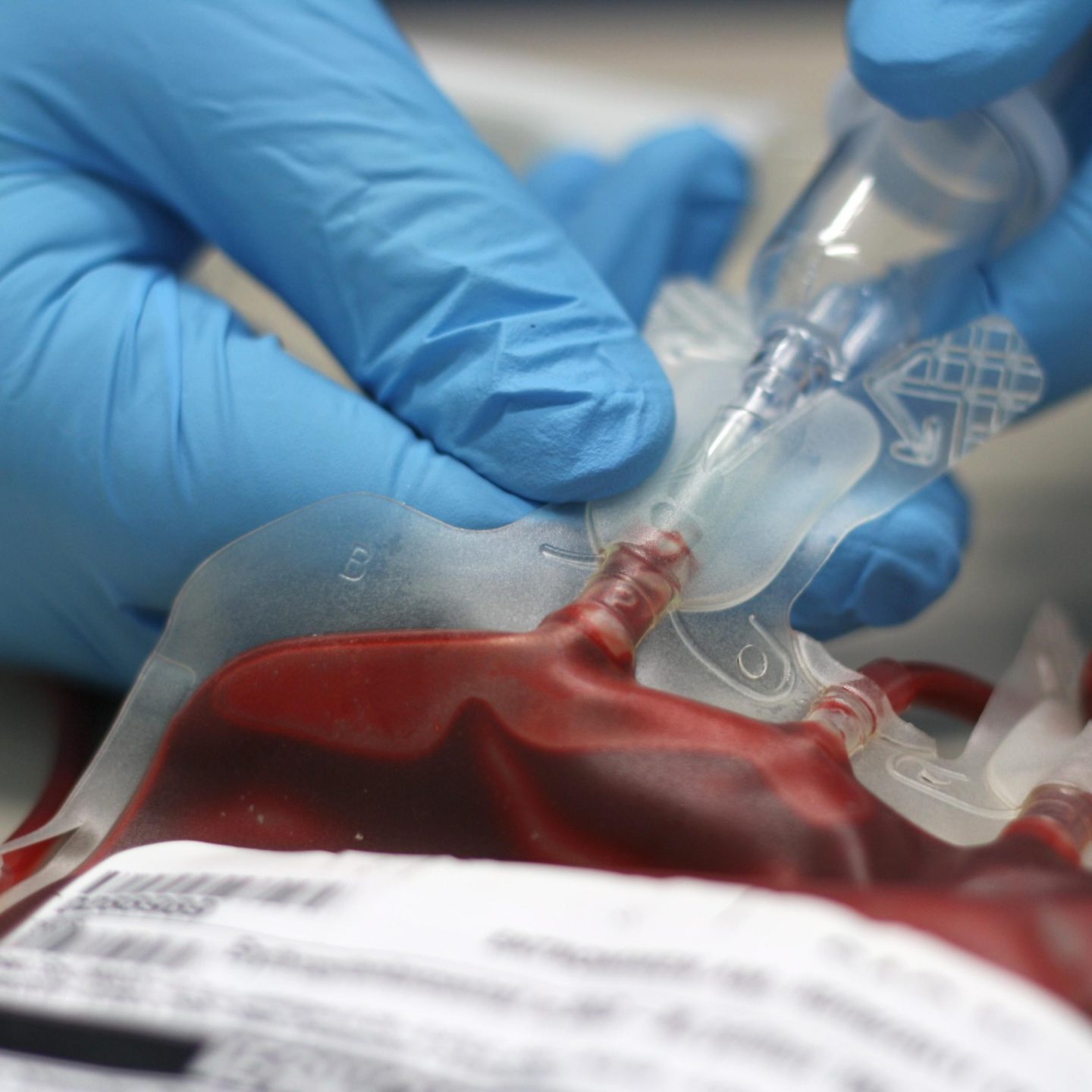 ما الذي يمنع العلماء من صنع دم اصطناعي يمكن منحه لكل محتاج؟