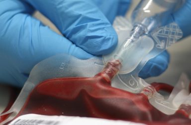 هل الحصول على منتجات دم اصطناعي أفضل من عدم الحصول على شيء؟ ما الذي يمنع إنتاج دم اصطناعي يستخدمه الأطباء وقت الحاجة بدل عمليات نقل الدم؟