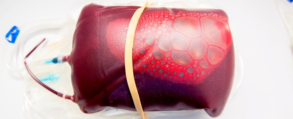 هل يمكن معالجة الخرف عن طريق نقل دم الشباب؟