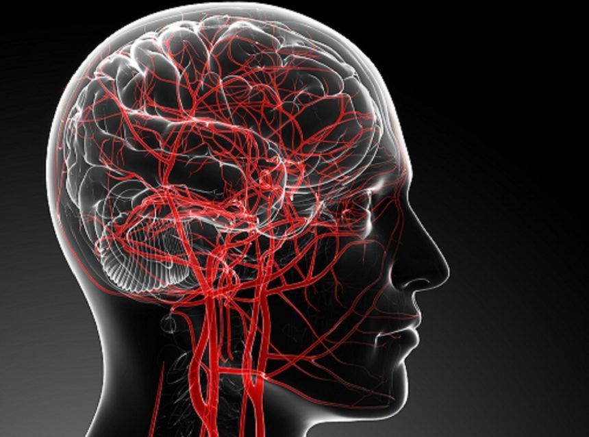 نقائل الدماغ : الأسباب و الأعراض و التشخيص و العلاج