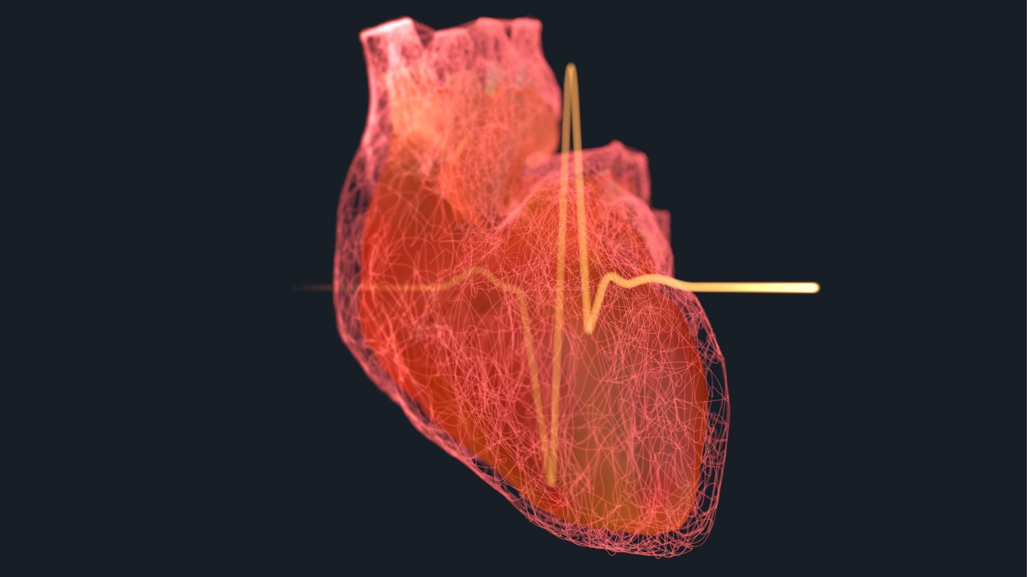 قصور القلب الانقباضي: الأسباب والأعراض والتشخيص والعلاج