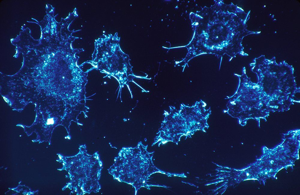 آلية جديدة يقاوم من خلالها السرطان العلاج المناعي