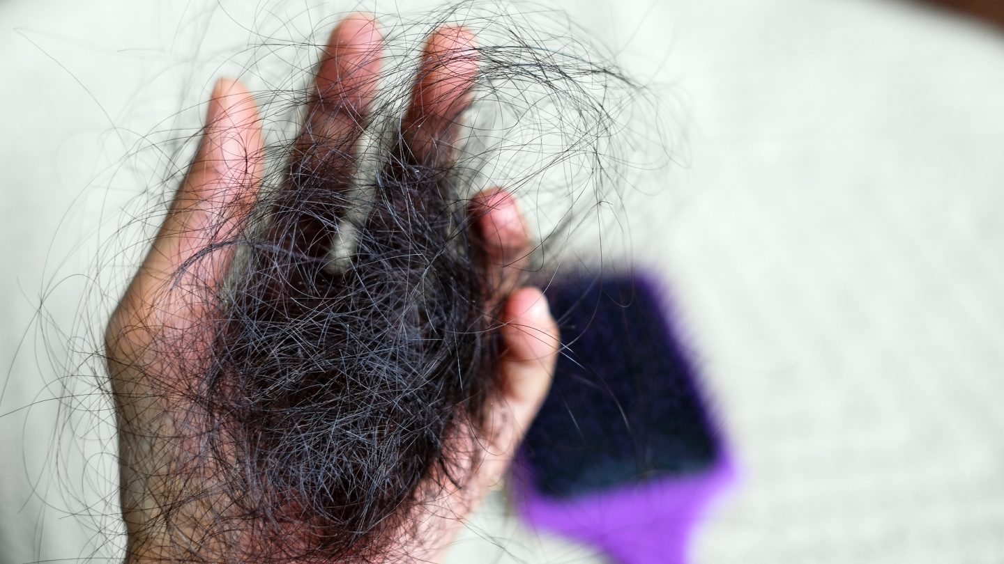 ماذا تقول أحدث الأبحاث عن تساقط الشعر وطرق إعادة نموه؟