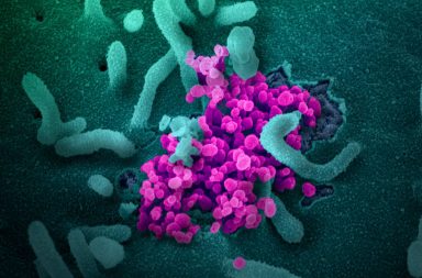 الأجسام المضادة التي تحمينا من فيروس كورونا لا تستمر إلا بضعة شهور - الأجسام المضادة لمرض كوفيد -19 قد تتلاشى خلال شهرين لدى المصابين غير العرضيين