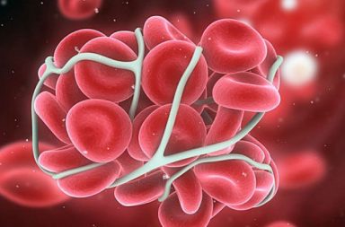 فرفرية نقص الصفيحات الخثارية: الأسباب والأعراض والتشخيص والعلاج - ما هو مرض Thrombotic Thrombocytopenic Purpura (TPP) - مرض دموي