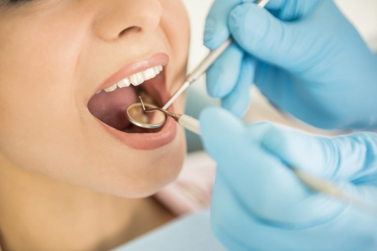 ما هي الأسنان الميتة؟ الأعراض والأسباب والعلاج