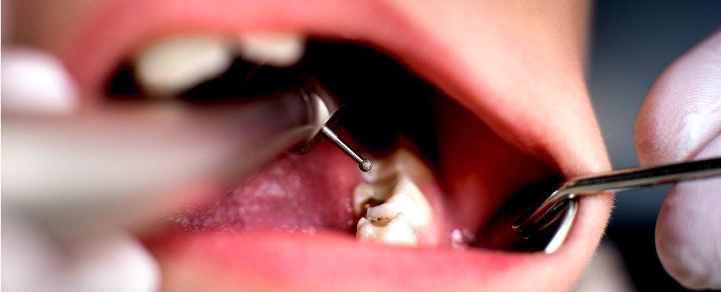 هناك علاقةٌ مدهشةٌ بين صحة الأسنان وصحة أعضاء الجسم