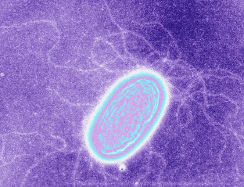 بكتيريا تتغذى على الطاقة في أنقى صورها - الإلكترونات!