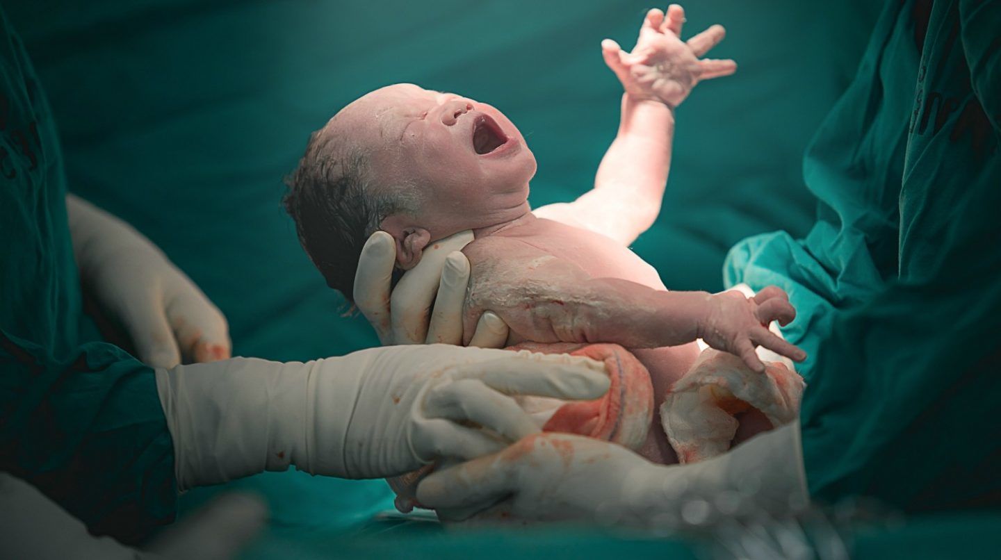 دراسة جديدة تظهر مدى التشوه الذي تلحقه الولادة المهبلية بالجنين