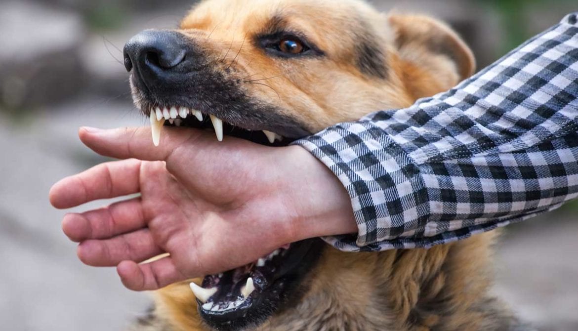 كيف نتعامل مع عضة الكلب؟ - نصائح لتلافي وعلاج عضات الكلاب - كيفية العناية بإصابة عضة الكلب - ماذا تفعل عند الإصابة بعضات الكلاب