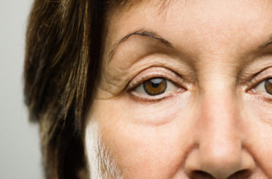 ما أسباب تدلي جفن العين - أسباب ترهل جفن العين - لماذا قد تتتدلى جفون العينين - لماذا قد يتدلى الجلد فوق الجفن - ضعف العضلة الرافعة للجفن