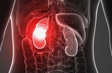 القصور الكلوي الحاد Acute Kidney Injury