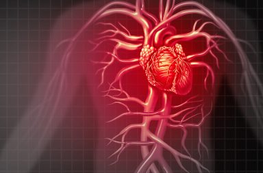 متلازمة وولف باركنسون وايت: الأسباب والأعراض والتشخيص والعلاج - عيب خلقي في القلب يسبب شحنات كهربائية زائدة وغير منظمة - تسرع نبضات القلب