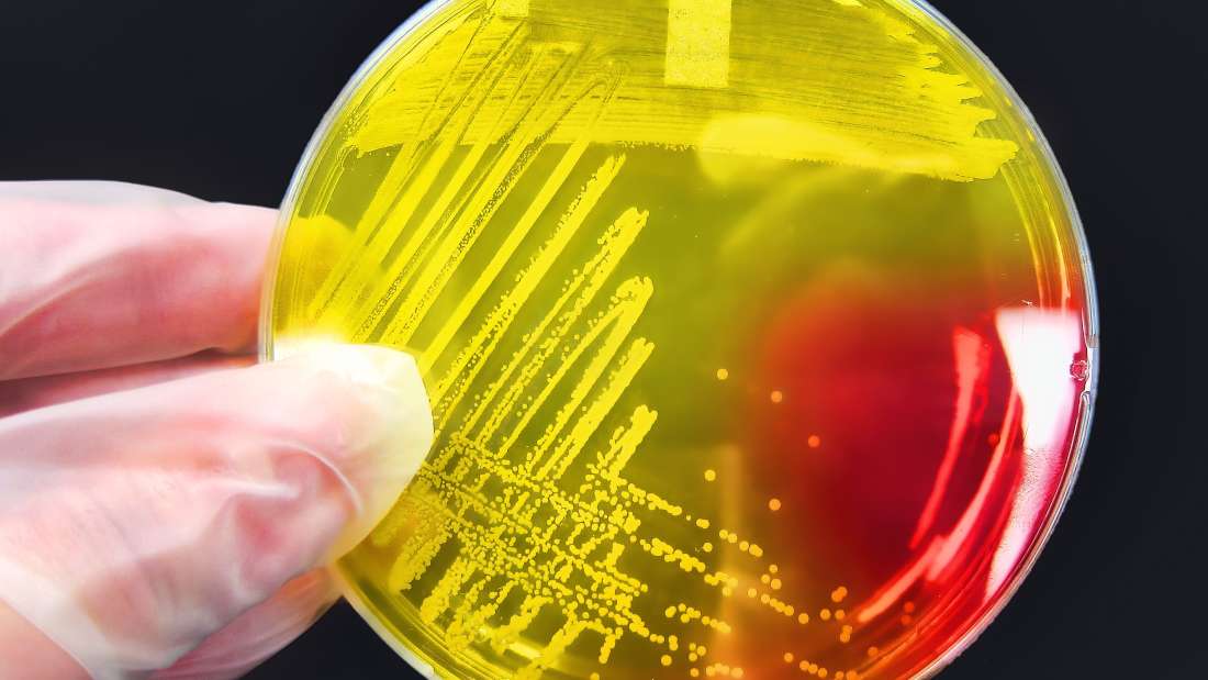 البكتيريا المقاومة للمضادات الحيويّة تغزو المستشفيات في جميعِ أنحاءِ العالم