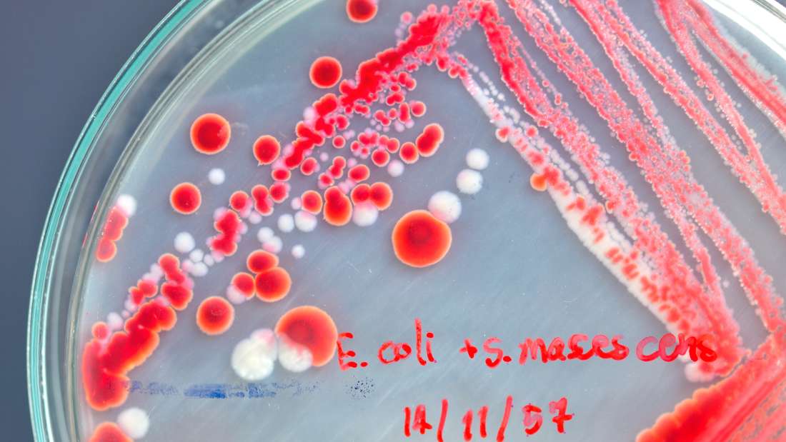 نجاح العلماء في تخليق أول بكتيريا مخبريًا