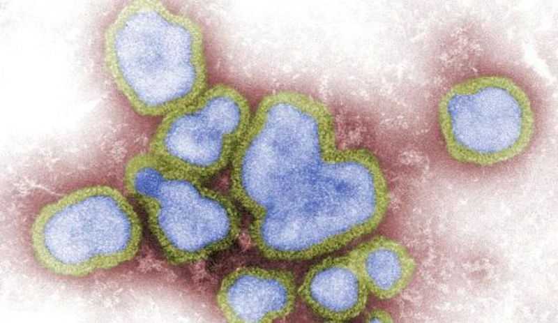 إنه الشتاء وقت الأنفلونزا ! فما هي الأنفلونزا ؟ أعراضها ، مسبباتها وطرق علاجها .