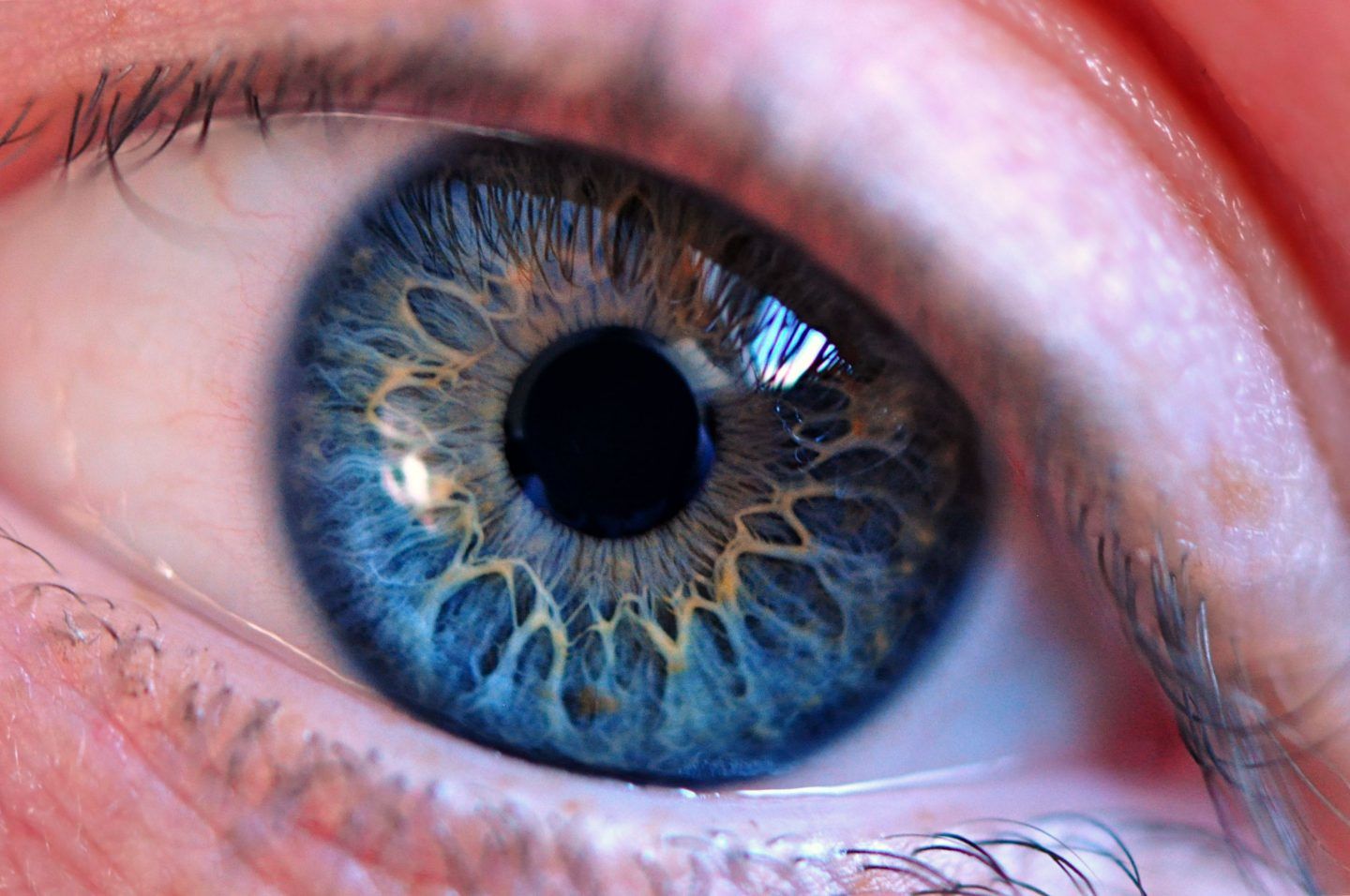ماذا لو أزلنا العدسة الموجودة في العين البشرية؟